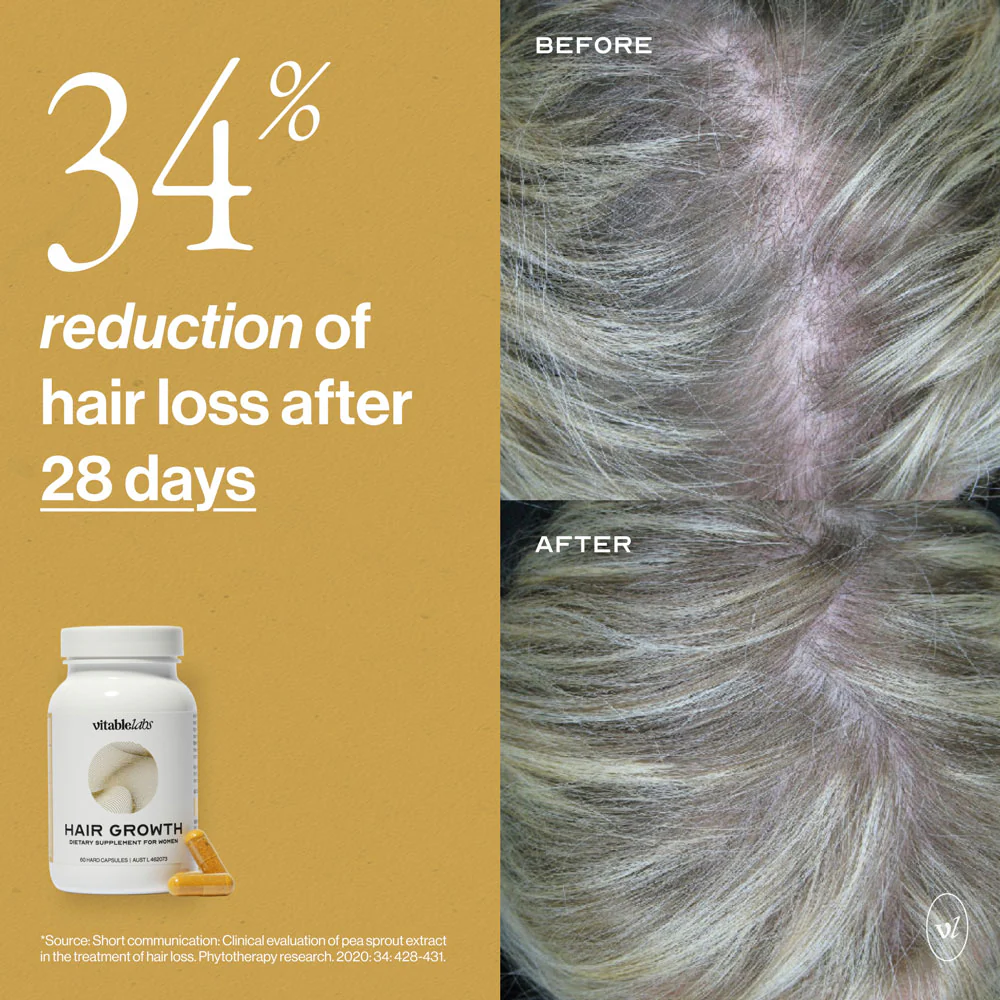 Hair Growth Capsules for Women - Image 9